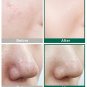 Some By Mi AHA. BHA. PHA 30 Days Miracle Serum 50ml +Free Sample