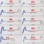PDR Auto Body Tools Push Rods Dent Repair Whale Tail Set Hail Ding Removal + Bag