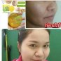 70 G.HO-YEON majesty Anti Melasma Honey Soap formula to reduce blemishes