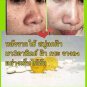 70 G.HO-YEON majesty Anti Melasma Honey Soap formula to reduce blemishes