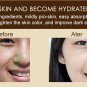 Moisturizing Face Cream Remove Age Spot Scar Pigment Whitening Anti Wrinkle