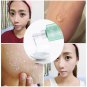 New arrivel Acid Peeling Gel Exfoliating Scale Facial Deep Carnation Remover