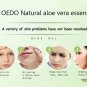 Aloe Vera Gel Hydrating Whitening Day Creams Acne Anti Aging Wrinkle Collagen