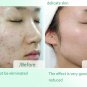 Aloe Vera Gel Skin Care Moisturizing Repair After Sun Dilute Acne Whitening
