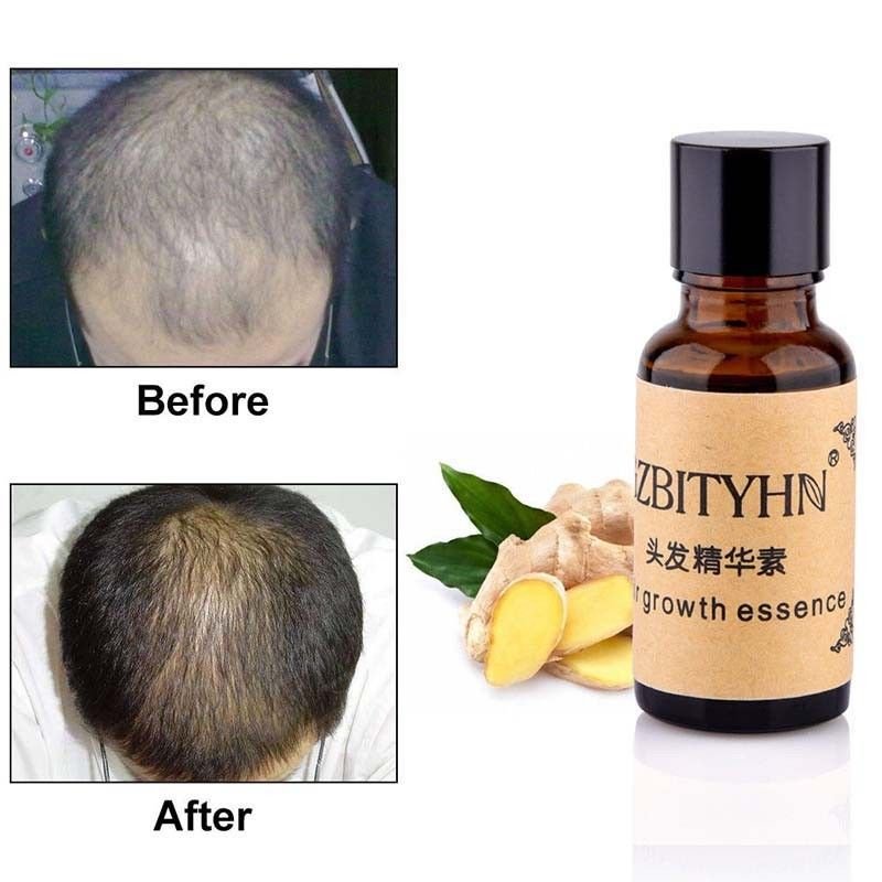 2pc 20ml Ginger Hair Growth Essence Hair Loss Liquid Dense Hair Fast Sunburst km80