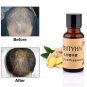 2pc 20ml Ginger Hair Growth Essence Hair Loss Liquid Dense Hair Fast Sunburst km80
