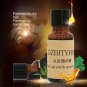 2pc 20ml Ginger Hair Growth Essence Hair Loss Liquid Dense Hair Fast Sunburst km80
