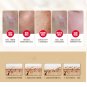 30g Scar Acne Mark Removal Gel Face Pore Skin Repair Stretch Cream Blemish New