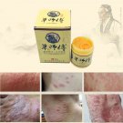Psoriasis Eczma Cream Works Perfect For All Kinds Of Skin Problems 29A psoriasis