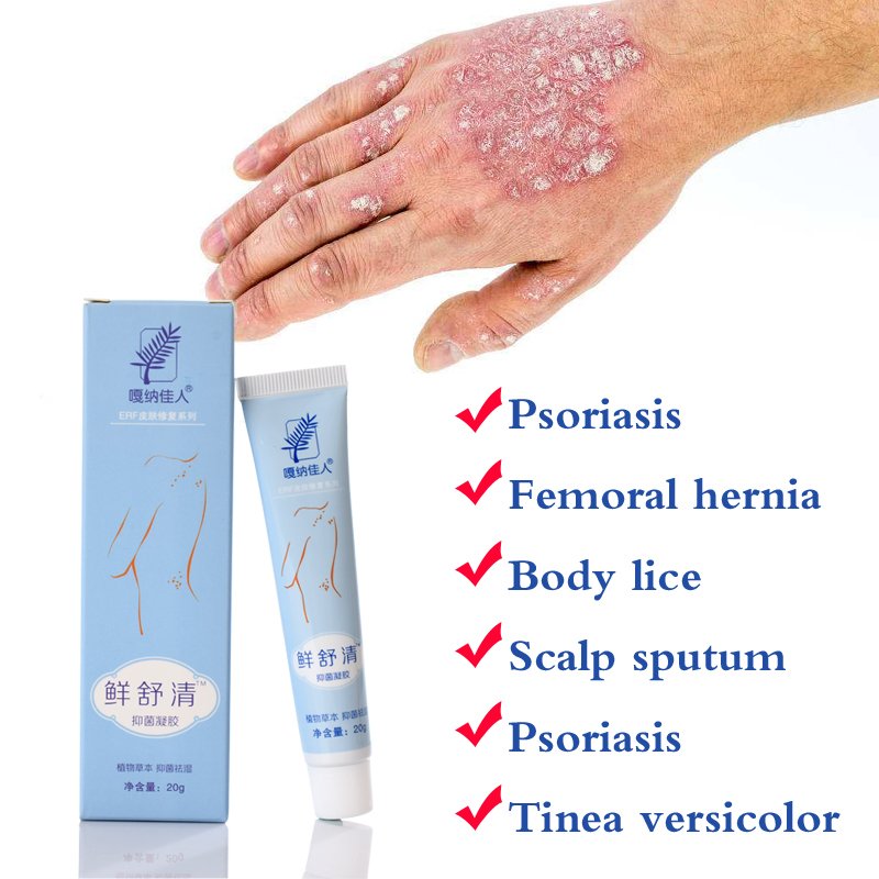 Professional Cure Psoriasis Ointment Original Works Perfect For All Of Skin
