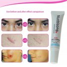 Super Cream Scar Remover Cream Remove Acne Spots And Striae - The Original NEW