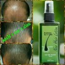 Neo Hair Lotion Anti hair Loss Green Wealth fall baldness Prevention