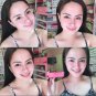 Ryx Skincerity Anti-Acne Whitening Foam Cleanser + Serum SET | For Men and Women All Skin Types