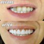 Snap On Teeth Cosmetic Secure Smile Instant Upper Veneers Dental False Natural