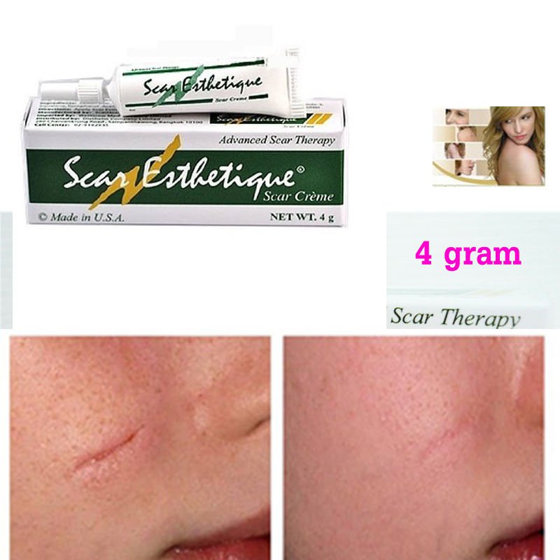 3x Scar Esthetique Cream SCAR THERAPY Treatment fade Burns KELOID ACNE SCAR 4g.