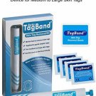 Auto TagBand Skin Tag Remover Device for Medium to Large Skin Tags