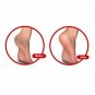 Silicon Gel Heel Protector & Plantar Fasciitis Socks for Men & Women (1 Pair)