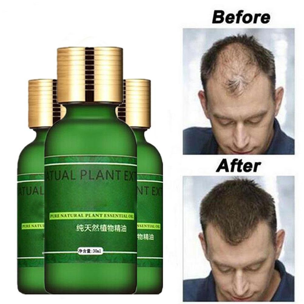 100% Pure Plant Based Natural Fast Hair Growth Oil 100% ORGANIC THE ORIGINAL !!