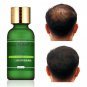 100% Pure Plant Based Natural Fast Hair Growth Oil 100% ORGANIC THE ORIGINAL !!