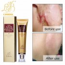 100% Ginseng Extract Scar Removing Bleaching Cream / Acne Remover / Original