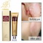 100% Ginseng Extract Scar Removing Bleaching Cream / Acne Remover / Original