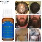 Beard Growth Oil Beard Growth Spray Hair Loss Products For Men Beard Facial Hair