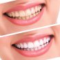 Dapiz - Teeth Whitening Kit