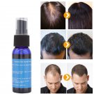 3pcs Lanthome Unisex Hair Loss Treatment Hair Spray Ginger Extract Hair Regrowth