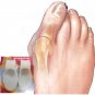1Pair High Heels Silicone Foot Care Tool Insoles Orthotics Bunion Pedicure Feet