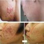 The best product to repair your skin 2018 free shipping