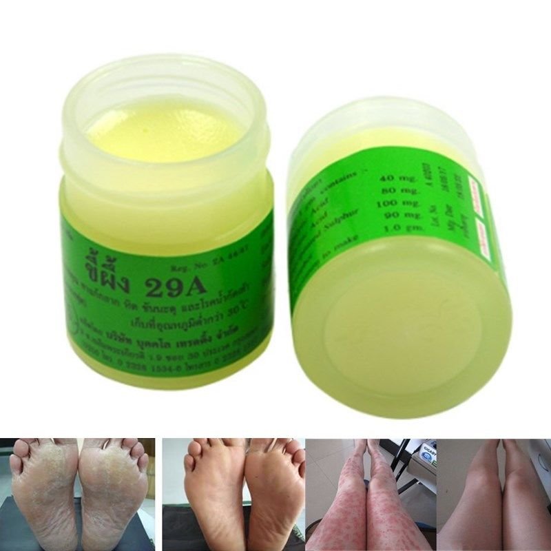 10Pcs/lot Psoriasis Cream and Eczema Dermatitis Therapy Ointments Herbal
