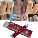 Nail Fungus Treatment / Onychomycosis Paronychia / Anti Fungal Nail Infection Go