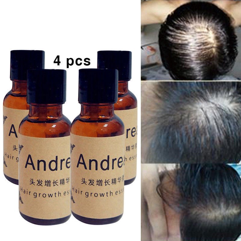 High Quality Andrea Hair Growth Essence Hair Loss Liquid 20ml Dense Hair Fast Su