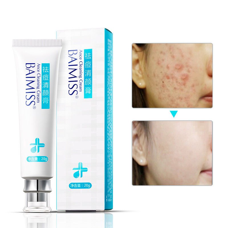 BAIMISS Acne Cleaning Cream Skin Care Remove Repair Comedone Pimple Acne