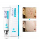 BAIMISS Acne Cleaning Cream Skin Care Remove Repair Comedone Pimple Acne