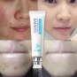 BAIMISS Acne Cleaning Cream Skin Care Remove Repair Comedone Pimple Acne