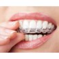 Teeth Whitening Kit -15 Treatments Say Hi To A Pearly White Smile Thousands Sold