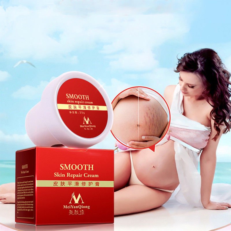 2018 powerful scar removal and Stretch Mark cream (Standard Shipping)