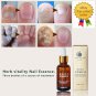 Health Skin Care Herbal Nail Repair Treatment Essential Oil Onychomycosis Remove