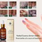 Health Skin Care Herbal Nail Repair Treatment Essential Oil Onychomycosis Remove
