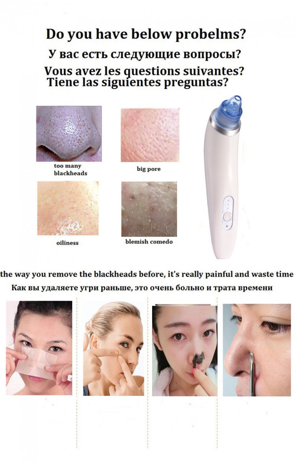 Vacuum Blackhead Ultra Cleansing Remover - Full Kit! (With English Manual)