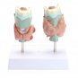 Human Anatomical Thyroid Gland Pathology Anatomy Medical Teaching Model