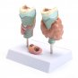 Human Anatomical Thyroid Gland Pathology Anatomy Medical Teaching Model