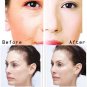 Ultrasound 3 Colors LED Photon Ultrasonic Skin Rejuvenation Beauty Device