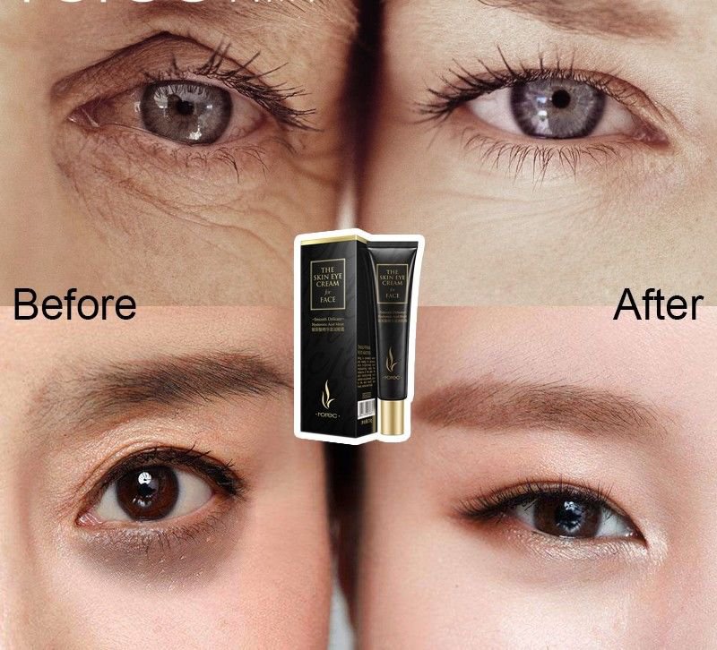 Same Effects of PLEXADERM rapid Eye Anti Aging Wrinkles Cream Improve