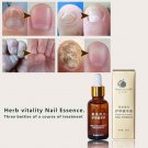 30g Finger Toe Care Anti Fungal Nail Treatment Nail Fungus Infection Essence Oil