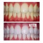 Zact Smokers Toothpaste Nicotine Stains Tobacco Whitening Bad Breath Halitosis