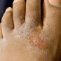 Yoki Radiant Powder Remedy Smelly Feet Sweaty Feet Athletes Foot Stinky Feet