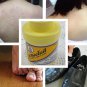 Yoki Powder Prickly Heat Acne Sweaty Dermatitis Rosacea UV Protection Psoriasis