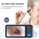 Otoscope USB Endoscope in ear 3.9mm camera 4.5 inch screen Inspection Ear Nose